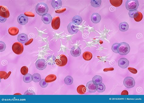 trombocitemie esentiala|Essential Thrombocythemia